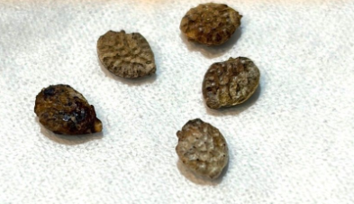 Adenia Pechuelii 5 Seeds